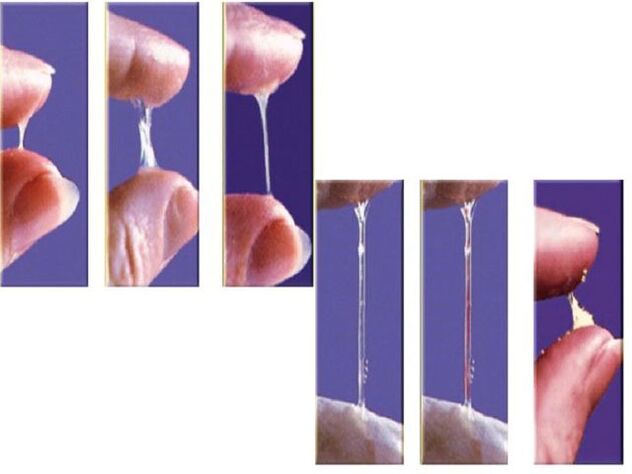 The consistency of the pre -ejaculation